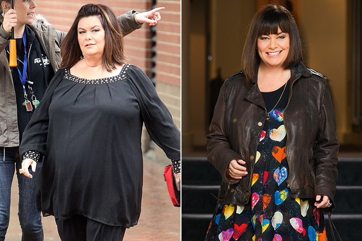 Dawn French's Laughter to Lifestyle Change: 