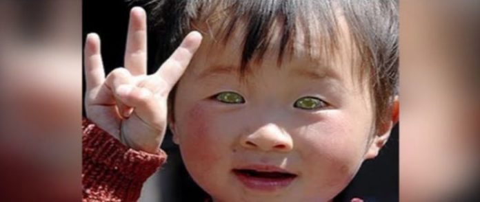 A Rare Gem: Unveiling Natural Asian Eye Color